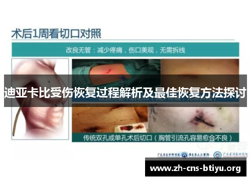迪亚卡比受伤恢复过程解析及最佳恢复方法探讨 迪亚卡比受伤恢复过程解析及最佳恢复方法探讨
